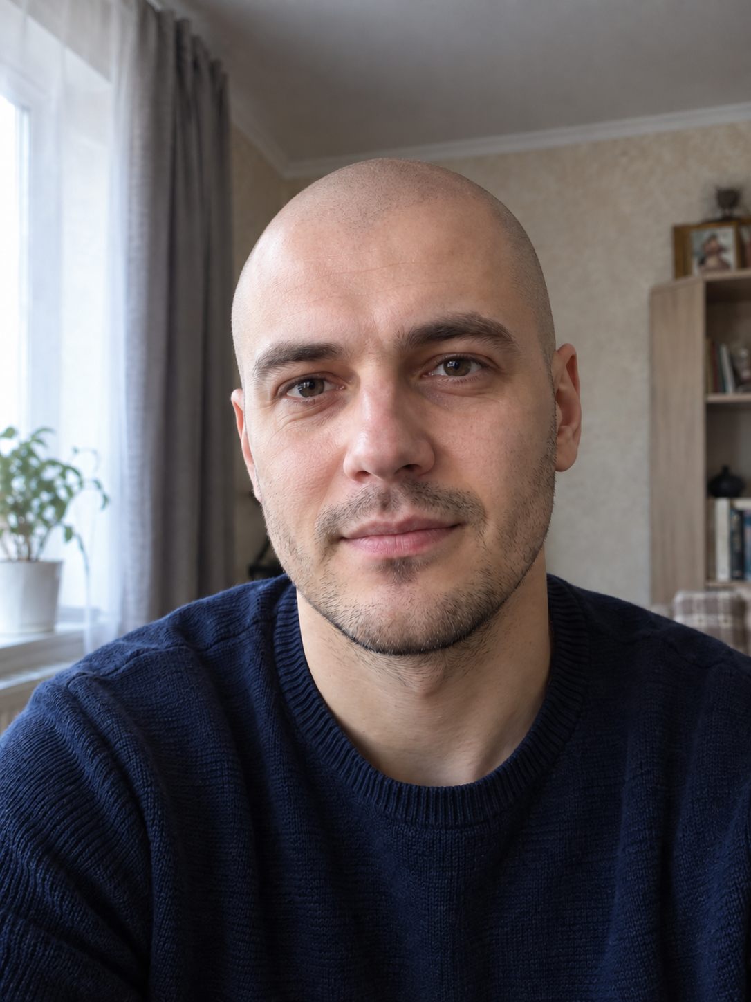 После — полностью лысый, форма головы своя